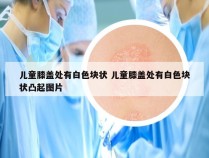 儿童膝盖处有白色块状 儿童膝盖处有白色块状凸起图片