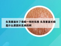 头发里面长了像癣一样的东西 头发里面长癣是什么原因长出来的啊