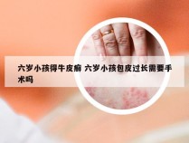 六岁小孩得牛皮癣 六岁小孩包皮过长需要手术吗