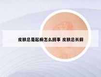 皮肤总是起癣怎么回事 皮肤总长藓