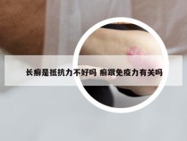 长癣是抵抗力不好吗 癣跟免疫力有关吗