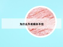 为什么牛皮癣长不住