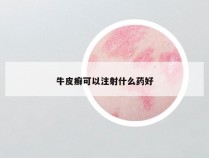 牛皮癣可以注射什么药好