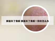 脚面长了像癣 脚面长了像癣一样的怎么办