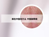 癣在中医叫什么 中医解释癣