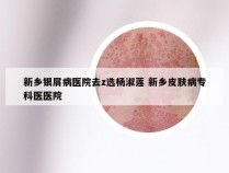 新乡银屑病医院去z选杨淑莲 新乡皮肤病专科医医院