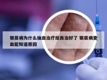 银屑病为什么抽血治疗反而治好了 银屑病查血能知道原因