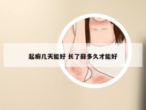 起癣几天能好 长了藓多久才能好