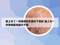 腿上长了一块像癣的东西扣下就掉 腿上长一块像癣越来越大干痒