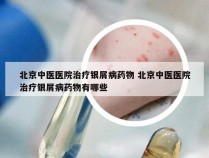 北京中医医院治疗银屑病药物 北京中医医院治疗银屑病药物有哪些