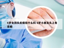 6岁女孩头皮癣挂什么科 6岁小朋友头上有皮癣