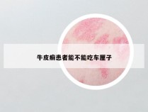 牛皮癣患者能不能吃车厘子