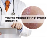 广安门中医院看银屑病谁好 广安门中医院看银屑病谁好点