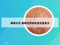 癣痒大王 癣痒王草本乳膏价格多少