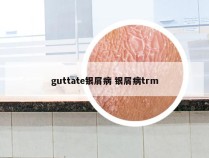 guttate银屑病 银屑病trm