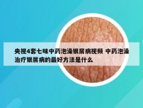 央视4套七味中药泡澡银屑病视频 中药泡澡治疗银屑病的最好方法是什么