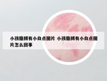 小孩胳膊有小白点图片 小孩胳膊有小白点图片怎么回事