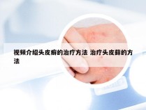 视频介绍头皮癣的治疗方法 治疗头皮藓的方法