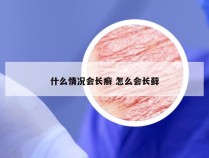 什么情况会长癣 怎么会长藓