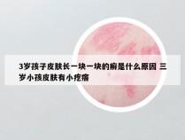 3岁孩子皮肤长一块一块的癣是什么原因 三岁小孩皮肤有小疙瘩