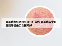 银屑病专科医院可以打广告吗 银屑病去专科医院好还是公立医院好