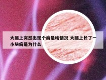 大腿上突然出现个癣是啥情况 大腿上长了一小块癣是为什么