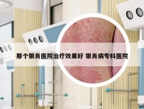 那个银肖医院治疗效果好 银肖病专科医院