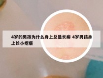 4岁的男孩为什么身上总是长癣 4岁男孩身上长小疙瘩