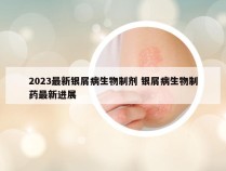 2023最新银屑病生物制剂 银屑病生物制药最新进展