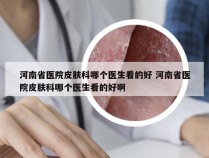 河南省医院皮肤科哪个医生看的好 河南省医院皮肤科哪个医生看的好啊