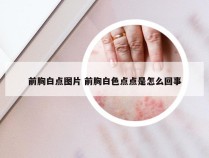 前胸白点图片 前胸白色点点是怎么回事