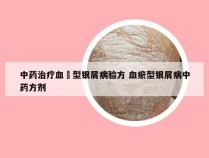 中药治疗血癒型银屑病验方 血瘀型银屑病中药方剂