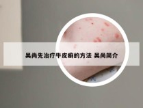 吴尚先治疗牛皮癣的方法 吴尚简介