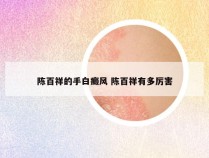 陈百祥的手白癜风 陈百祥有多厉害