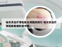 哈尔滨治疗掌趾脓包病医院排行 哈尔滨治疗掌跖脓疱病的老中医