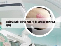 银康皮肤病门诊部怎么样 银康银屑病医院正规吗