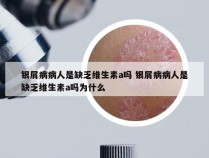 银屑病病人是缺乏维生素a吗 银屑病病人是缺乏维生素a吗为什么