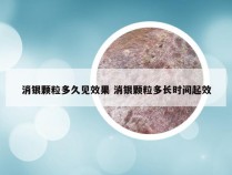 消银颗粒多久见效果 消银颗粒多长时间起效