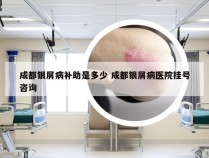 成都银屑病补助是多少 成都银屑病医院挂号咨询