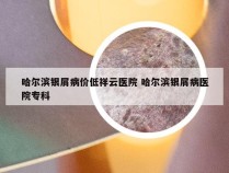 哈尔滨银屑病价低祥云医院 哈尔滨银屑病医院专科