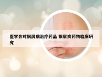 医学会对银屑病治疗药品 银屑病药物临床研究