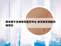 廊坊看牛皮癣哪家医院专业 廊坊银屑病医院哪家好