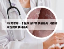 l河南省哪一个医院治好皮肤病最好 河南哪家医院皮肤科最好