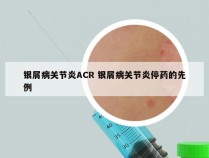 银屑病关节炎ACR 银屑病关节炎停药的先例