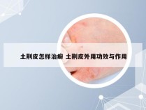 土荆皮怎样治癣 土荆皮外用功效与作用