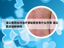 蒲公英熬水对治疗掌趾脓包有什么作用 蒲公英水消肿快吗