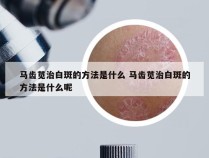 马齿苋治白斑的方法是什么 马齿苋治白斑的方法是什么呢