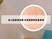 女人后背有白斑 女生后背有白色条纹