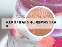 手上突然长藓为什么 手上突然长藓为什么会痒