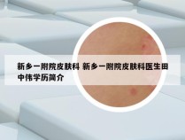 新乡一附院皮肤科 新乡一附院皮肤科医生田中伟学历简介